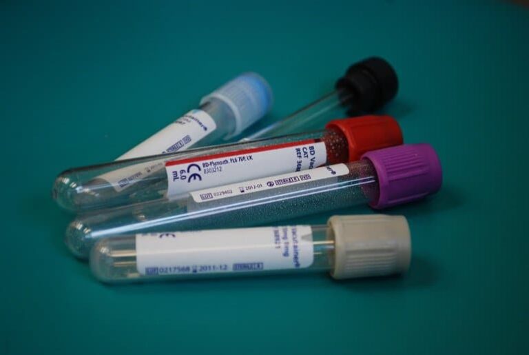 Alzheimers Biomarker Blood Neurosicnes Public.jpg