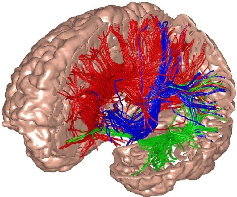 Ketamine Brain Noise Neurosucences.jpg