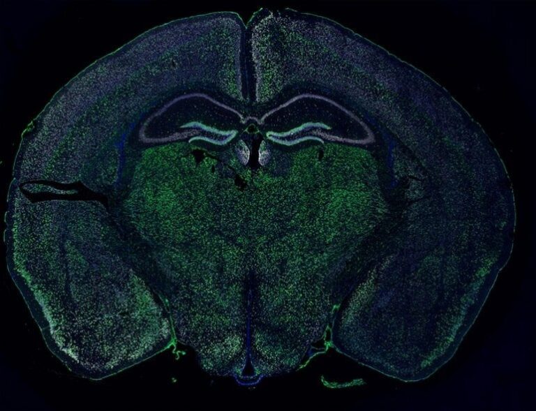 Neuron Material Transfer Neurosicnes.jpg