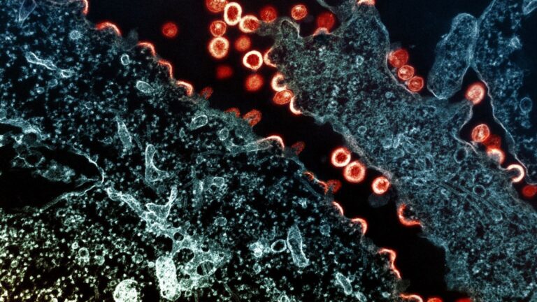 Hiv virus particles.jpg