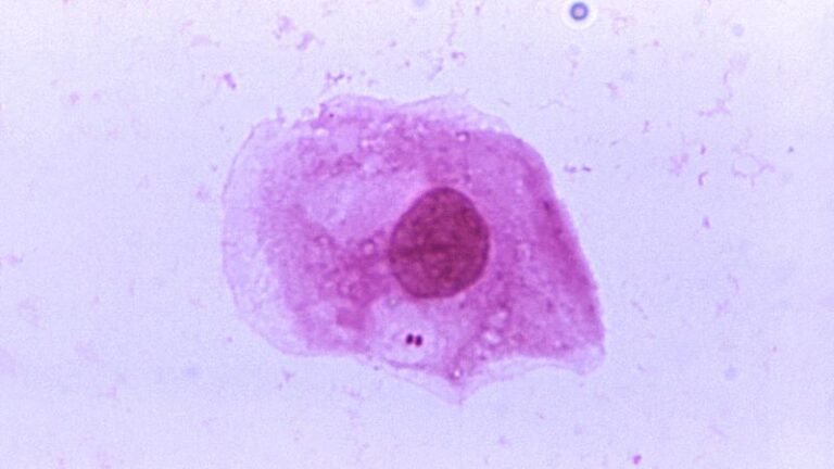 230902152824 Neisseria Meningitidis.jpg